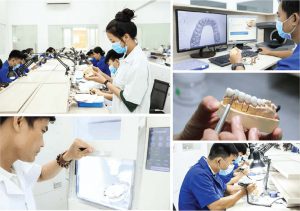 địa chỉ trồng răng implant uy tín hcm