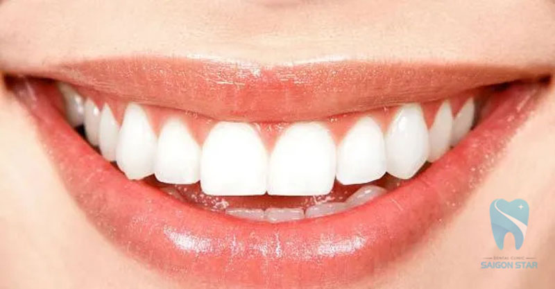 chăm sóc răng sứ zirconia