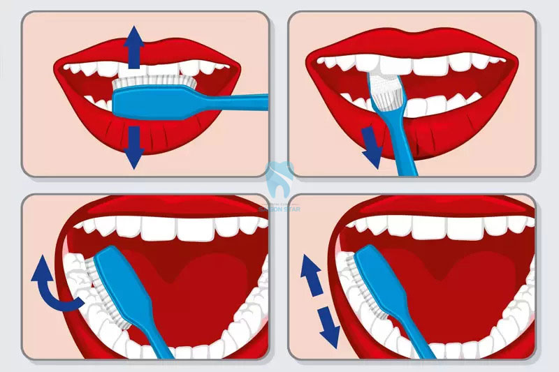 trồng răng giả bị hôi