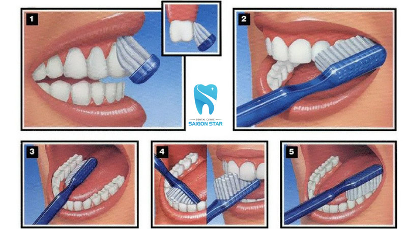 đánh răng đúng cách