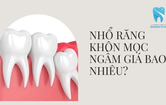 Nhổ răng khôn mọc ngầm giá bao nhiêu?