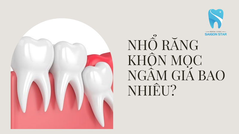 nhổ răng khôn mọc ngầm giá bao nhiêu