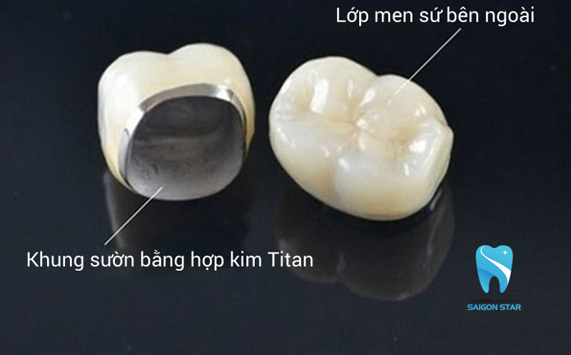 hợp kim titan