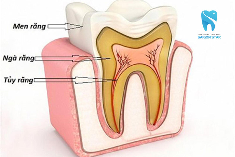 tuỷ răng là gì